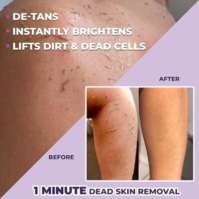 Tan Removal Creams Tan Removal Creams