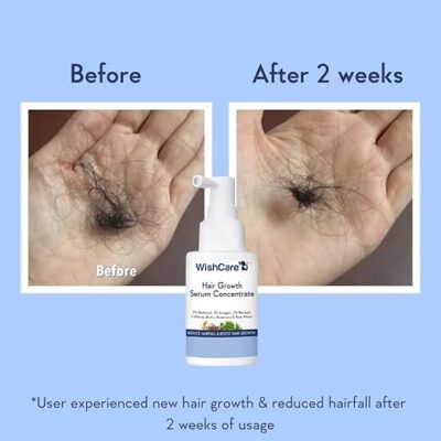 Hair Growth Serum